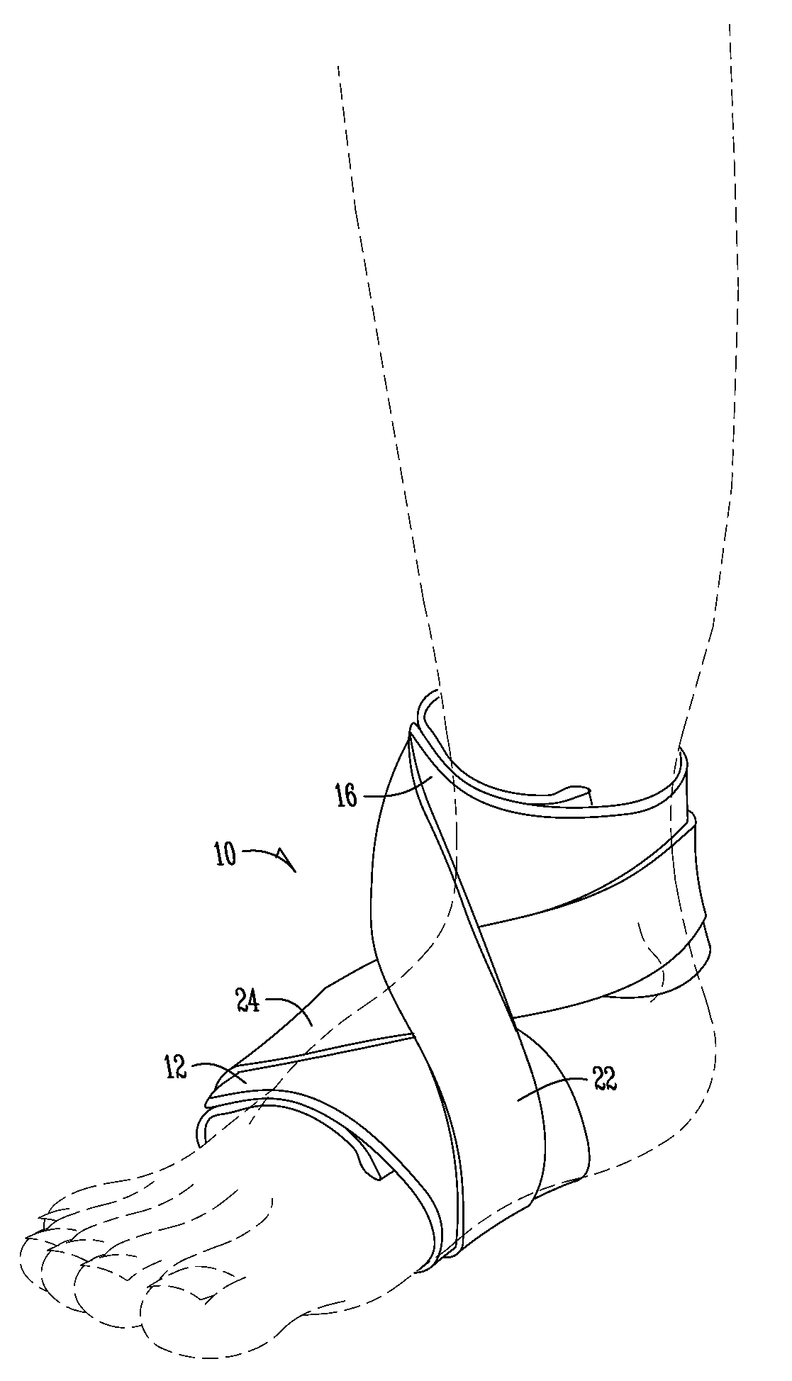 Soft wrap for treating plantar fasciitis