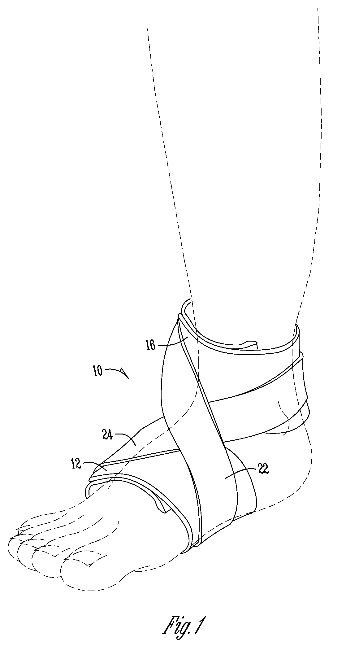 Soft wrap for treating plantar fasciitis