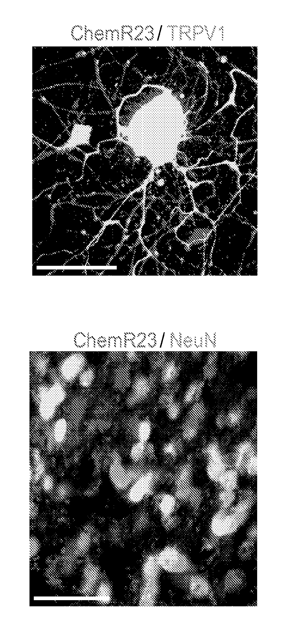 Method for treating neuropathic pain