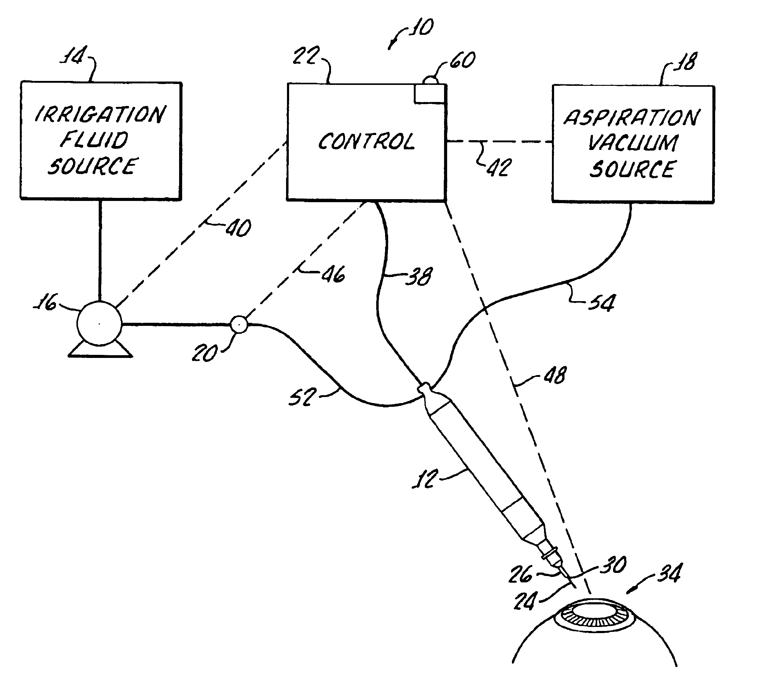 Method for controlling fluid flow to and from an eye during ophthalmic surgery