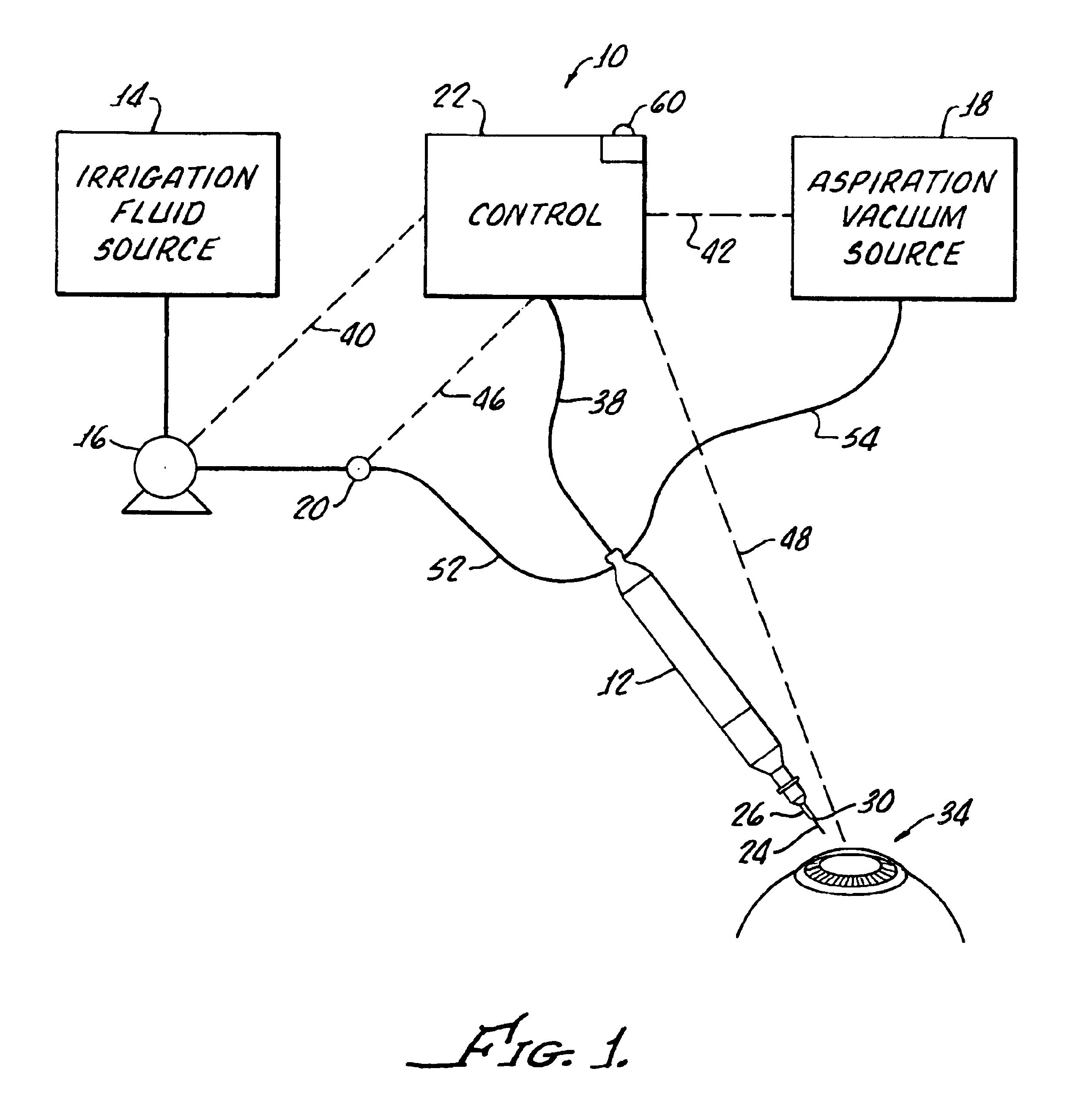 Method for controlling fluid flow to and from an eye during ophthalmic surgery