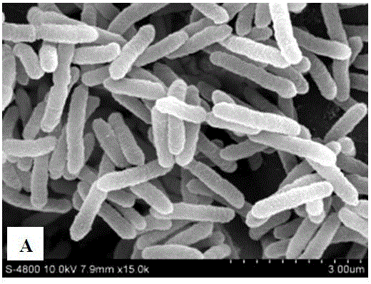 Sticking agent for making bacterial scanning electron microscope observation slice and preparation method thereof