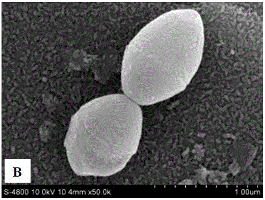 Sticking agent for making bacterial scanning electron microscope observation slice and preparation method thereof