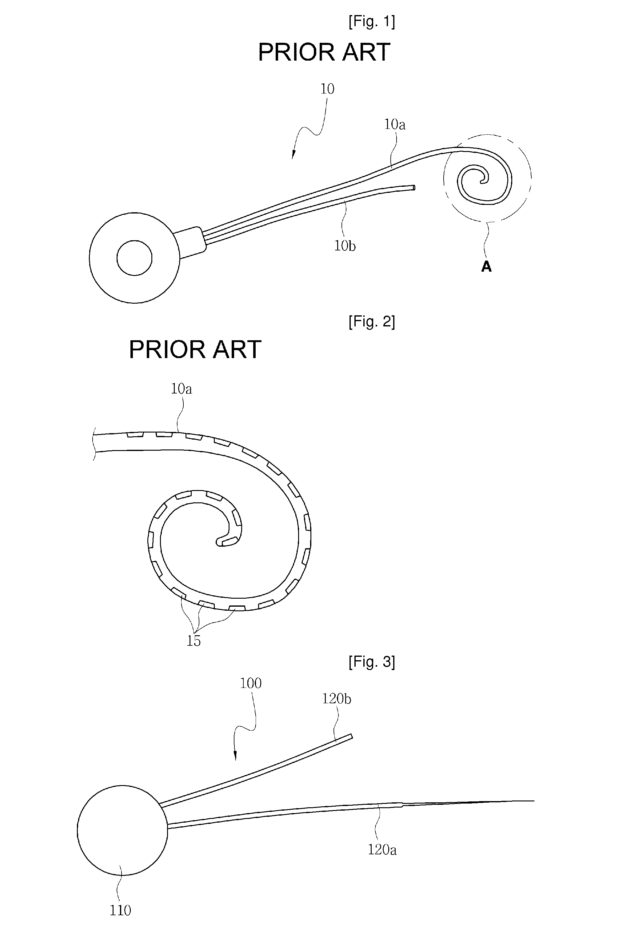 Cochlear implant