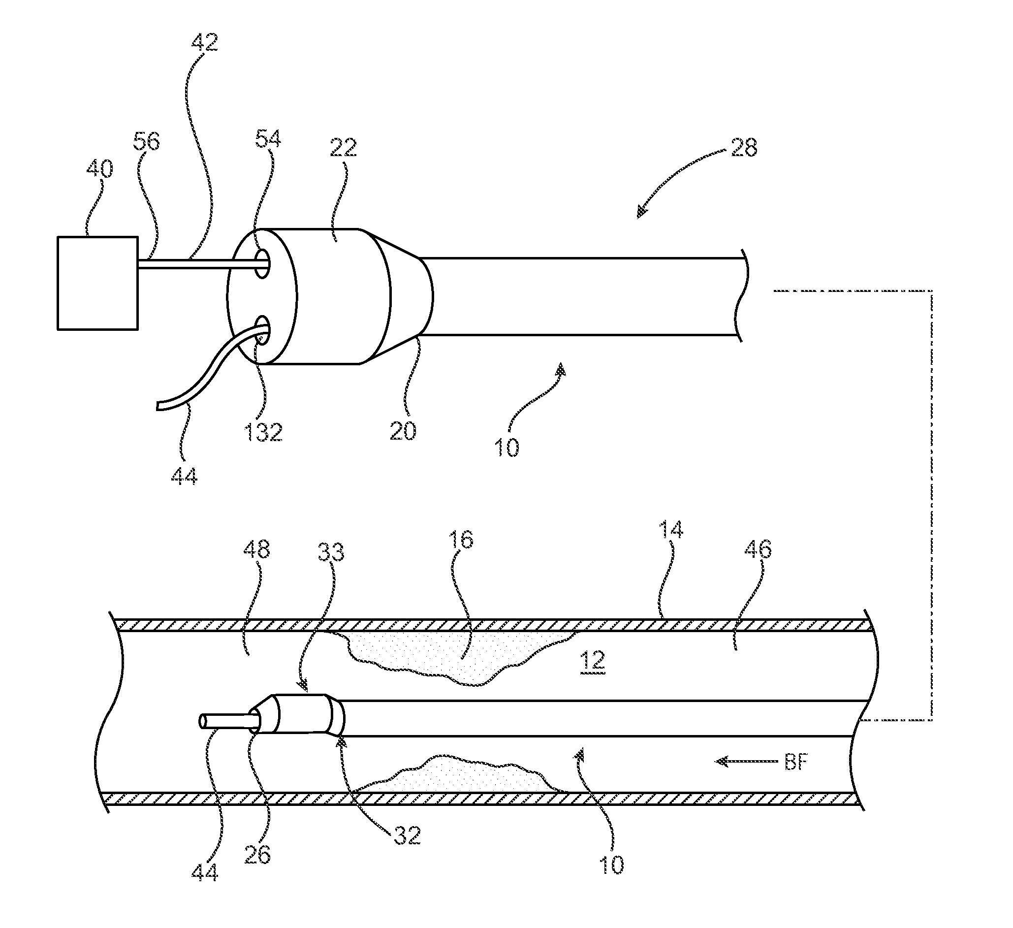 Pressure measuring catheter having reduced error from bending stresses