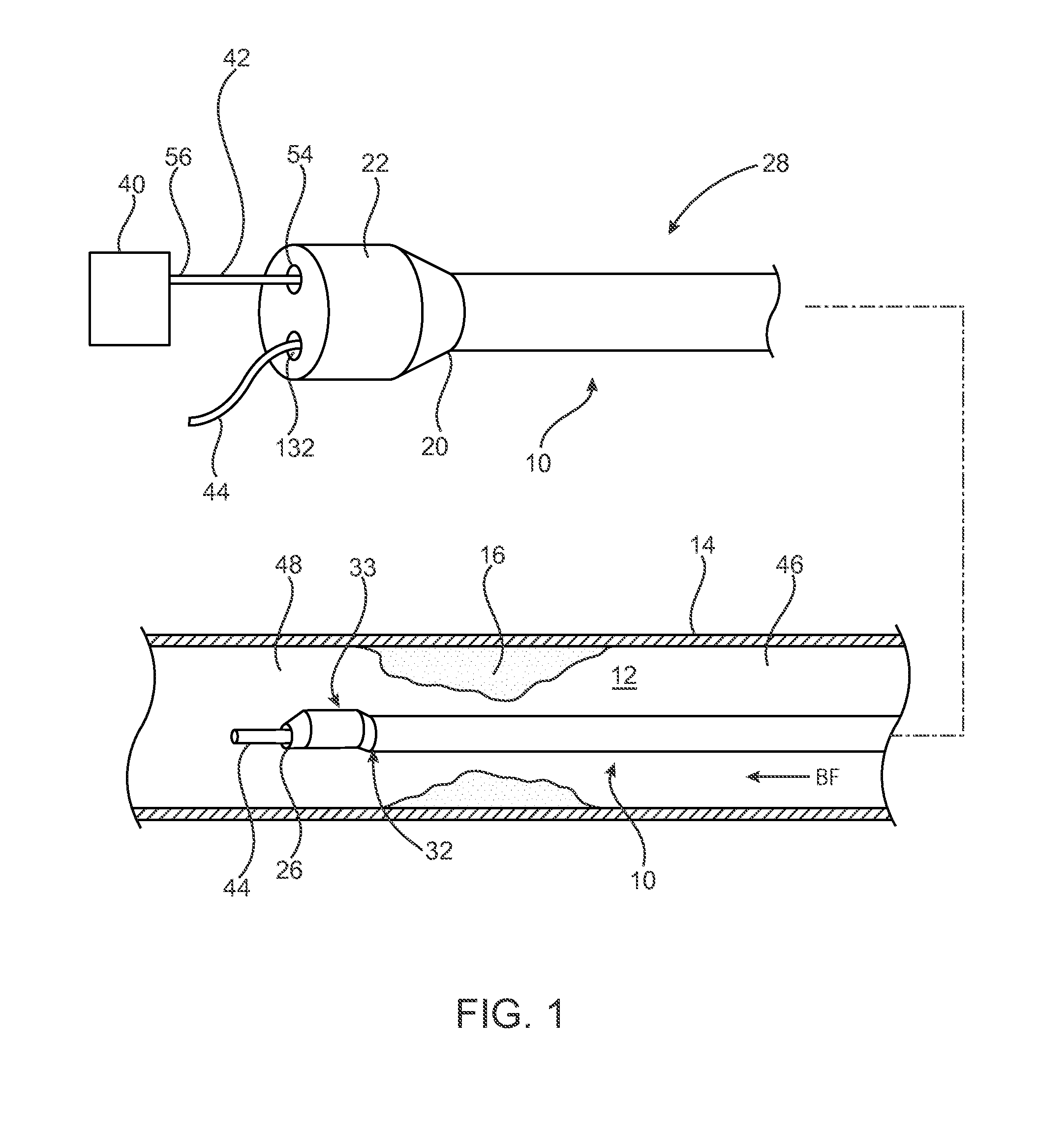 Pressure measuring catheter having reduced error from bending stresses