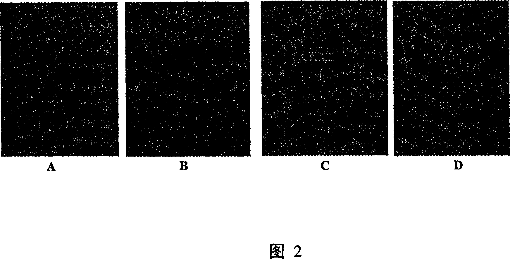 Gene chip for analyzing microbial group structure and function under acid environment