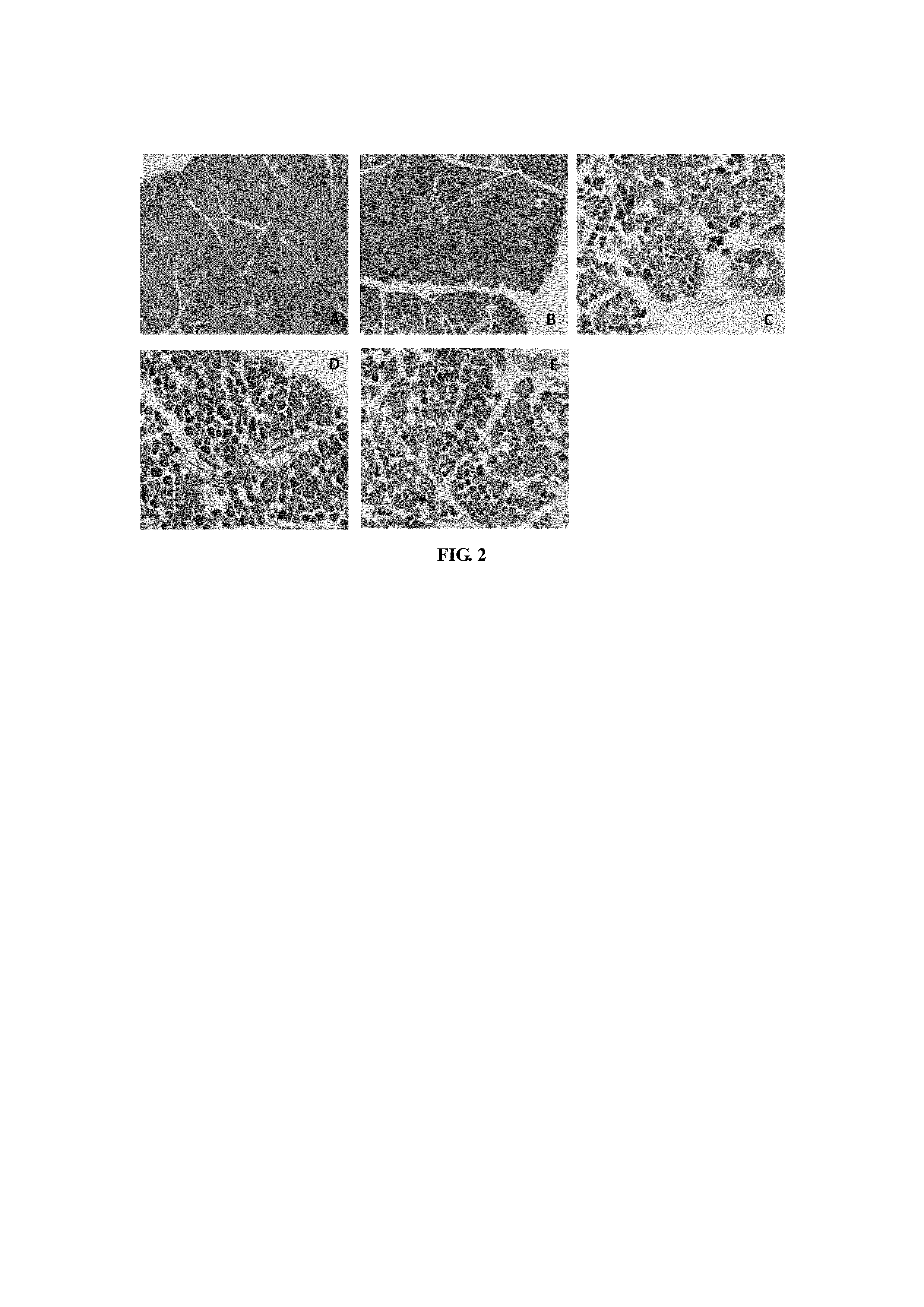 Method Of Using Rhein For Treating Fibrotic Conditions And Tumors