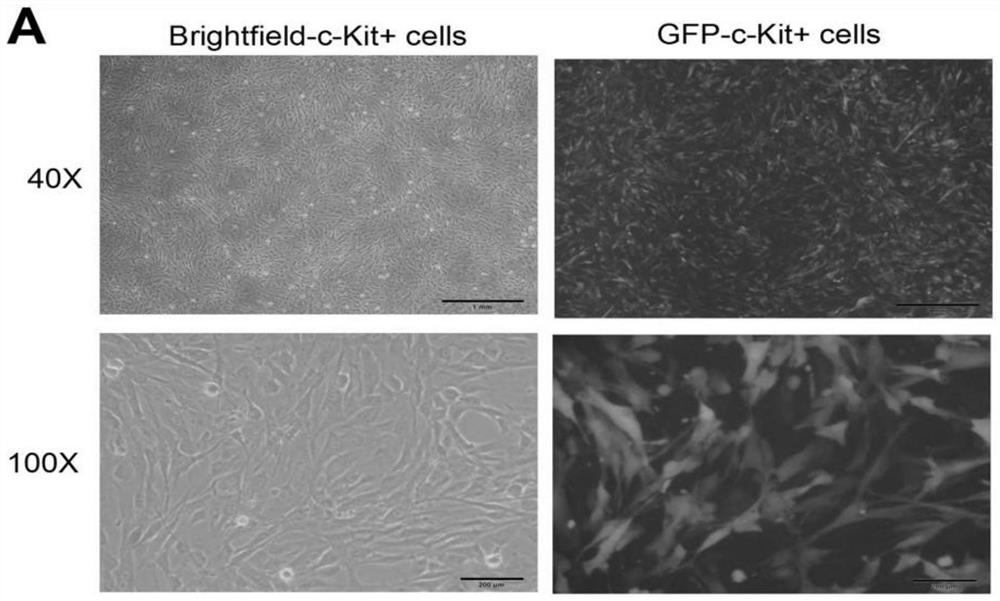 Preparation and application of cardiac cell exosome