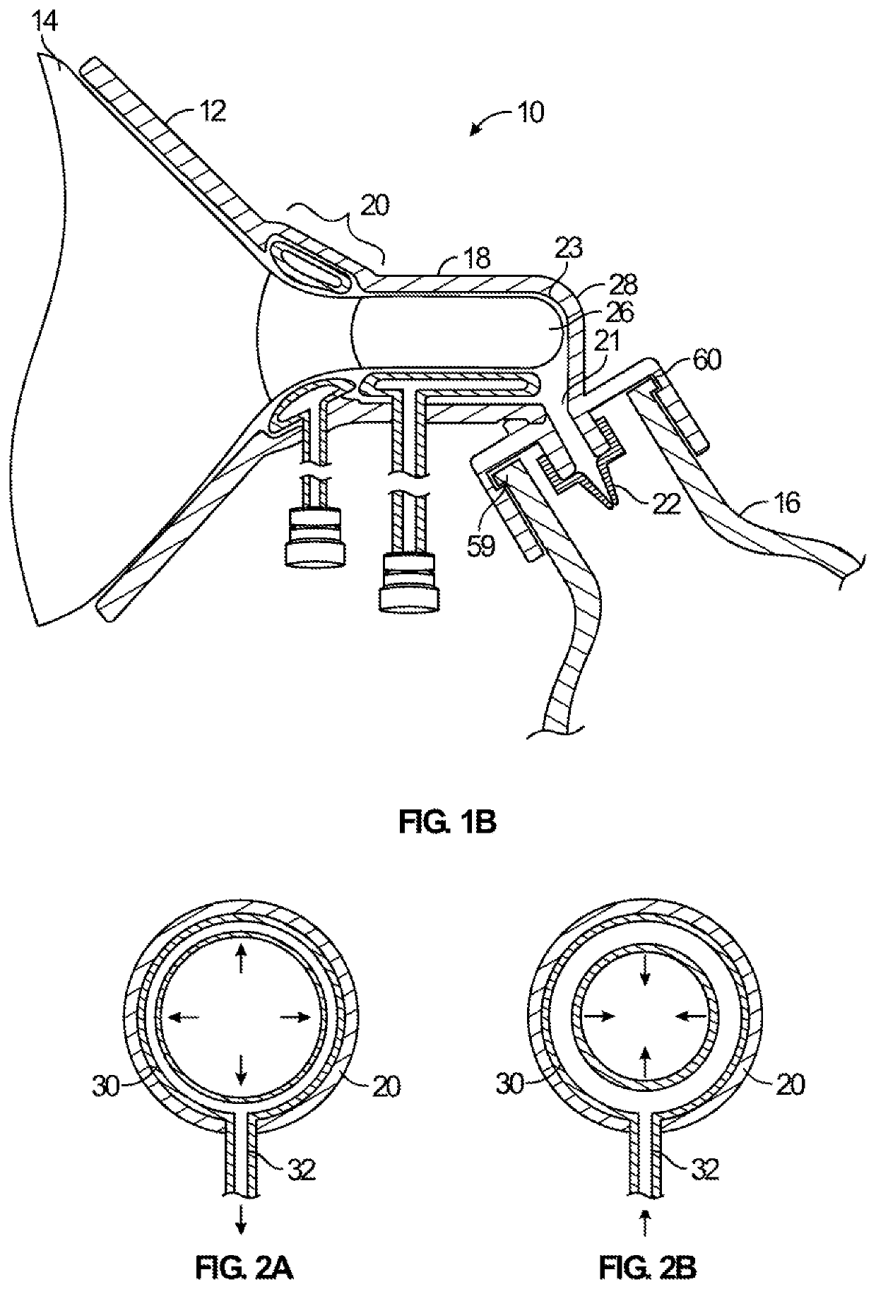 Breast pump