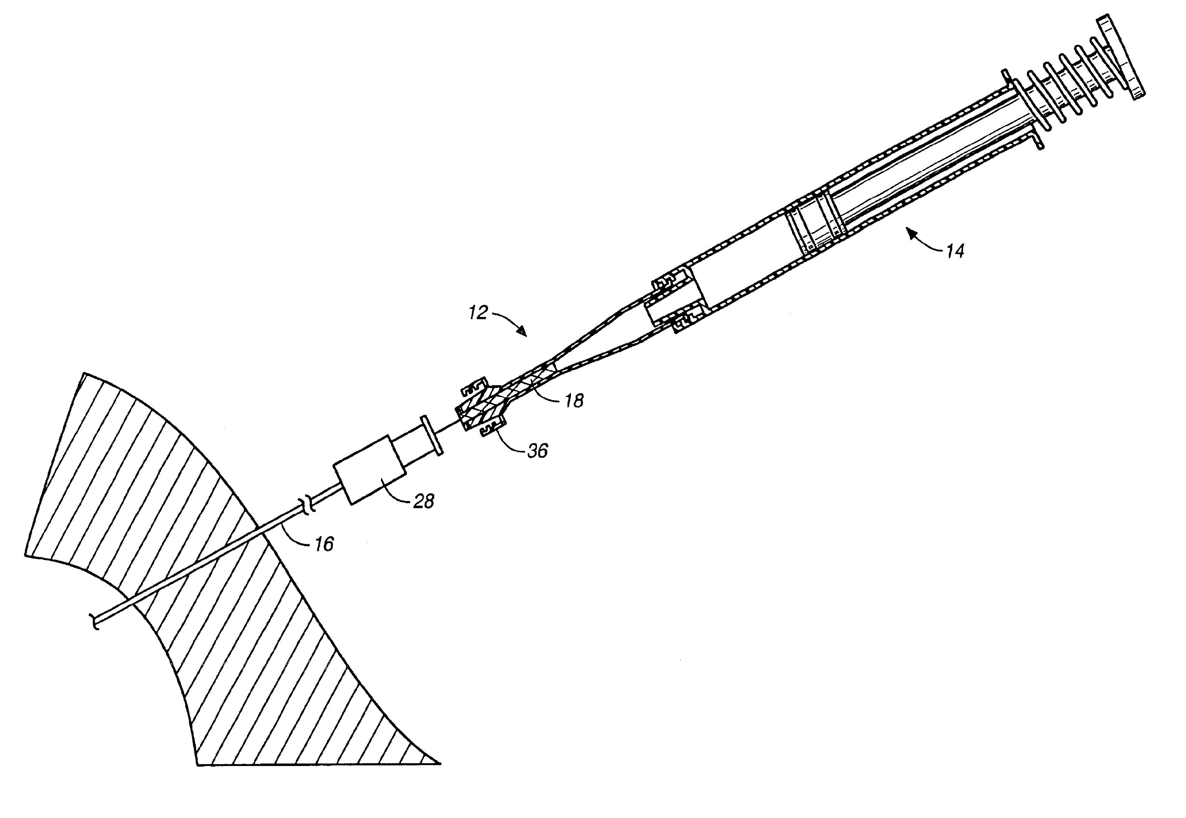 Device and method for facilitating hemostasis of a biopsy tract