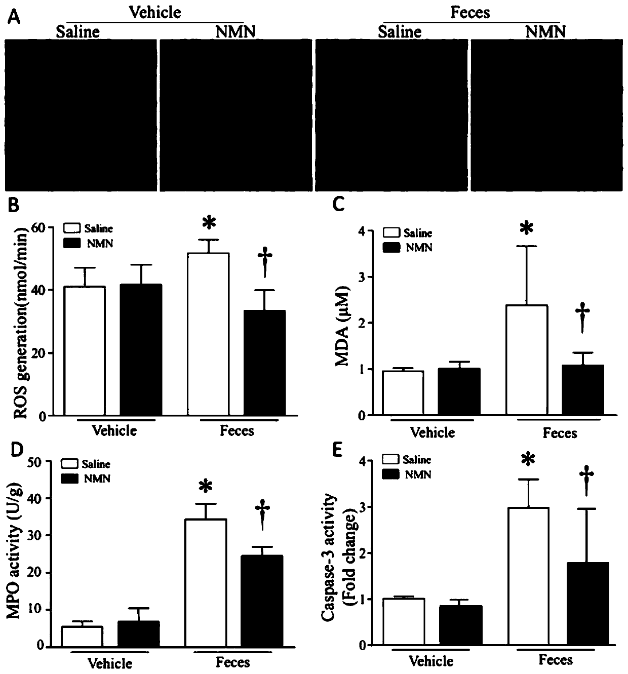 Application of beta-NMN in preparation of medicament for treatment and prevention of organ damage caused by sepsis