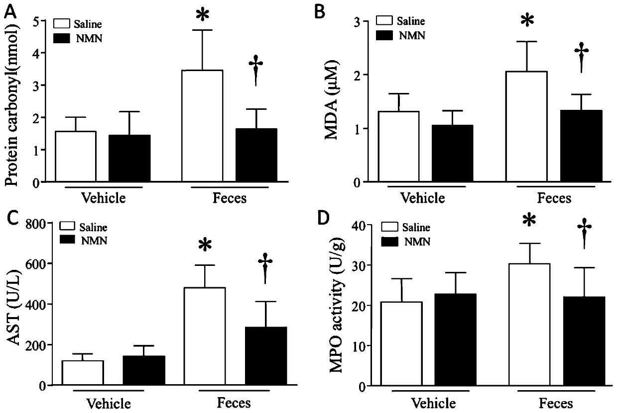 Application of beta-NMN in preparation of medicament for treatment and prevention of organ damage caused by sepsis