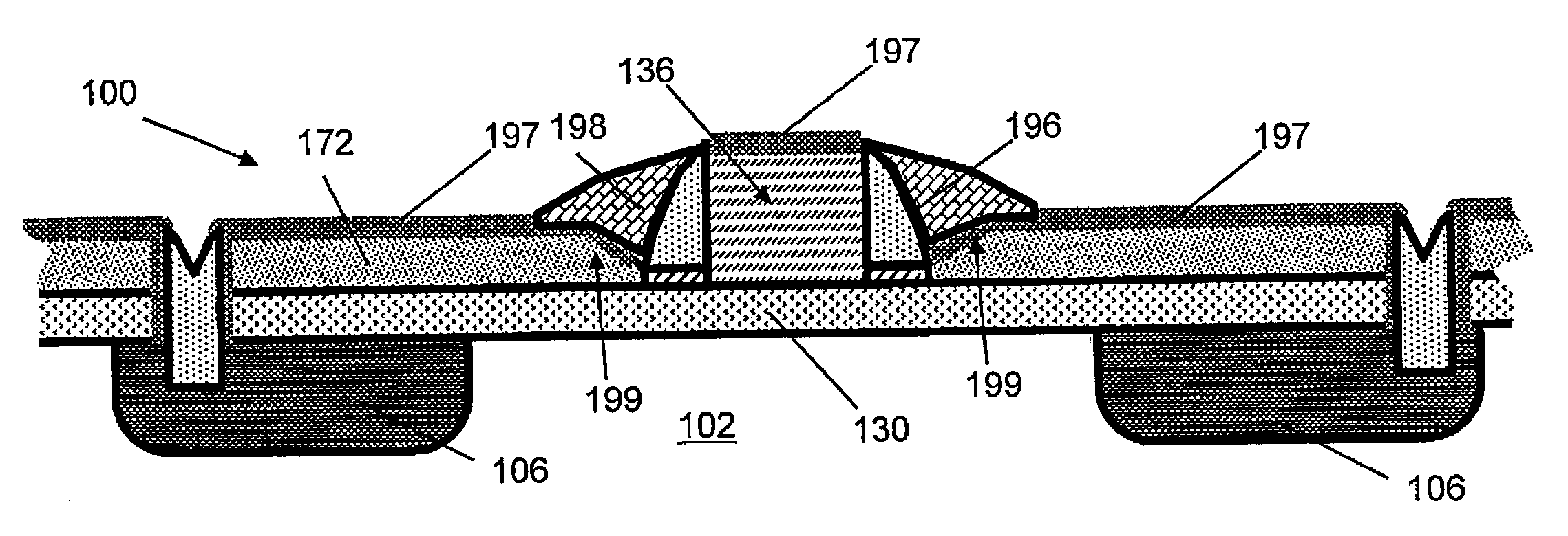 Monocrystalline extrinsic base and emitter heterojunction bipolar transistor and related methods