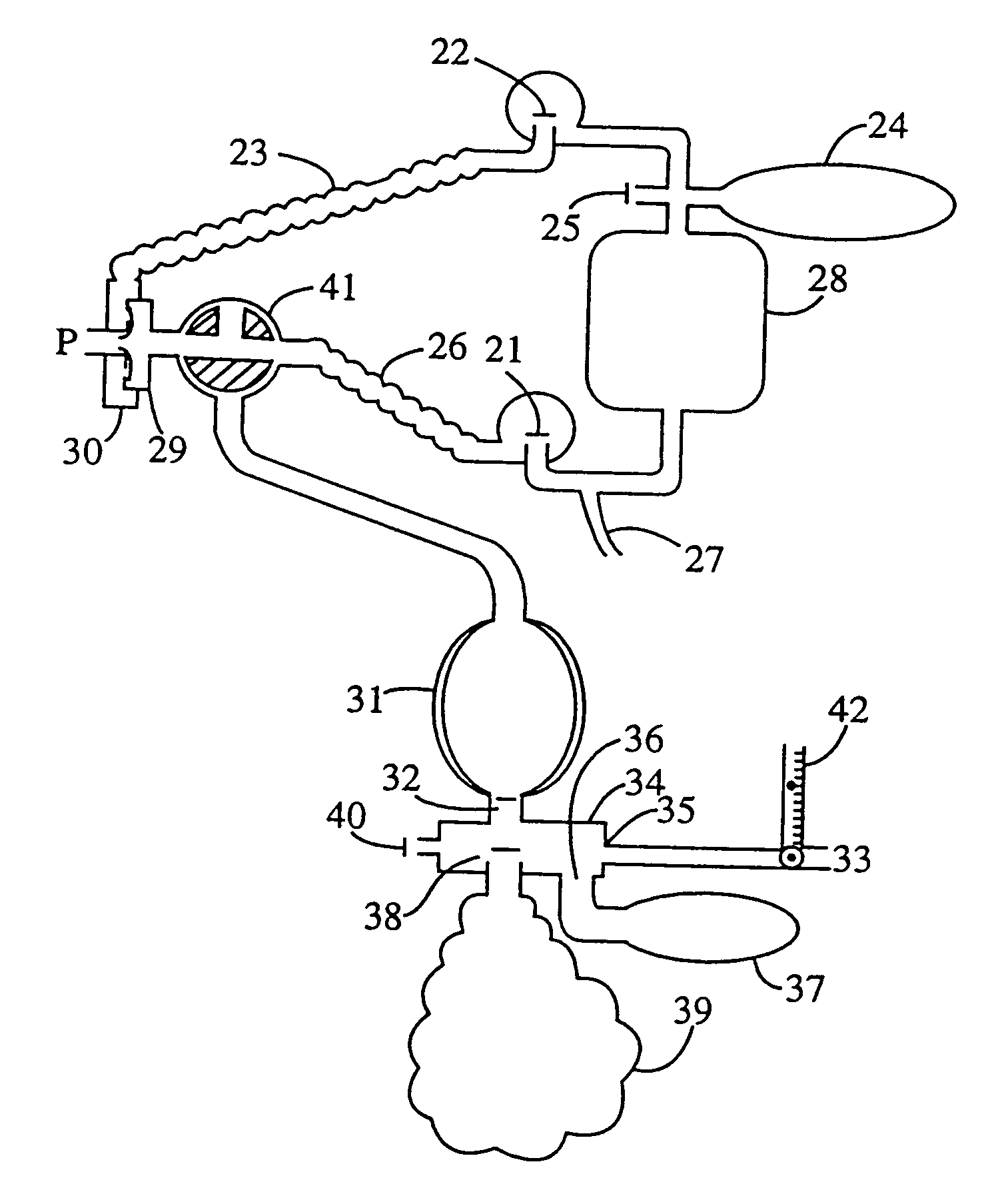 Method of maintaining constant arterial PCO2 and measurement of anatomic and alveolar dead space