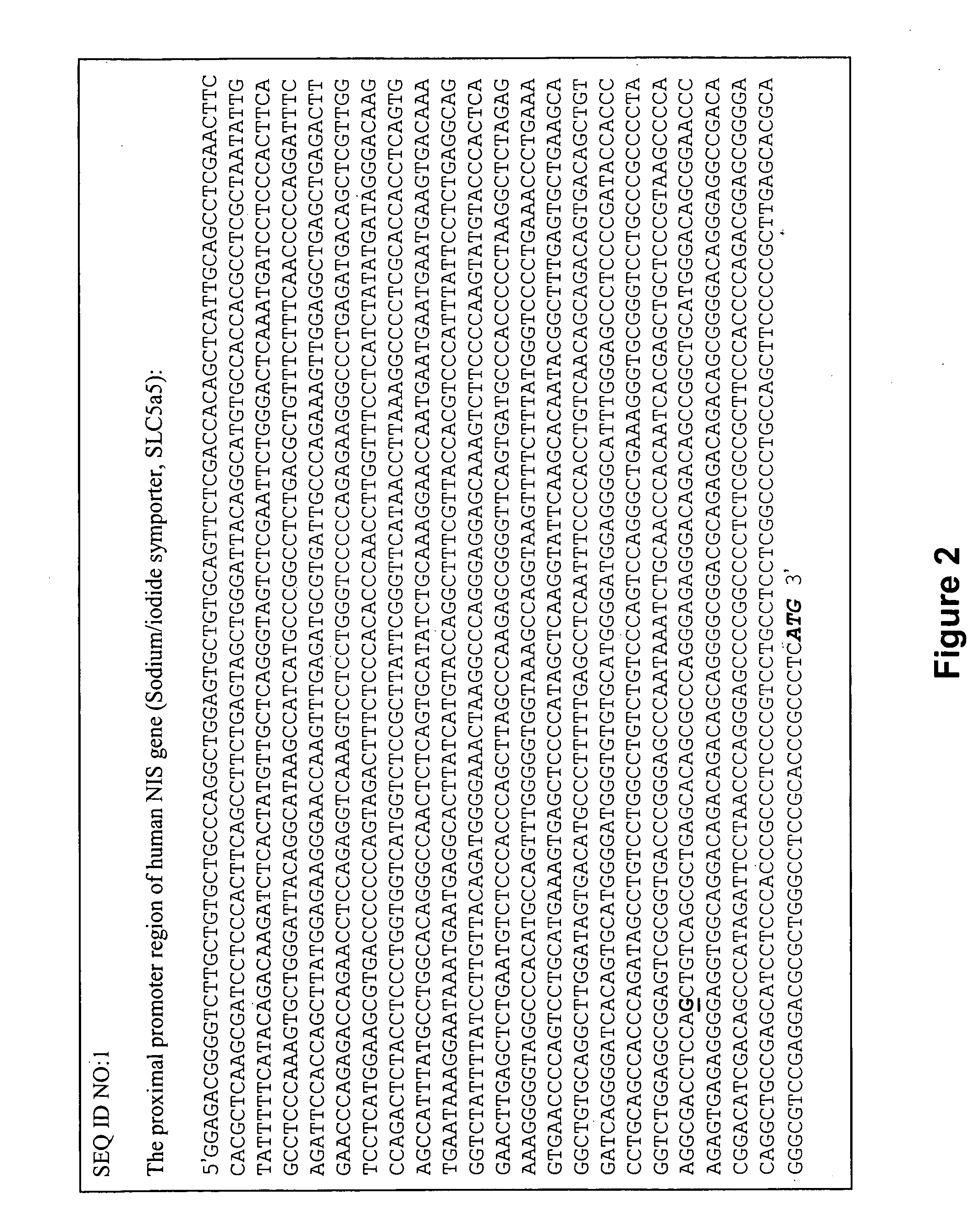 Transcriptional repression of sodium-iodide symporter in thyroid carcinoma