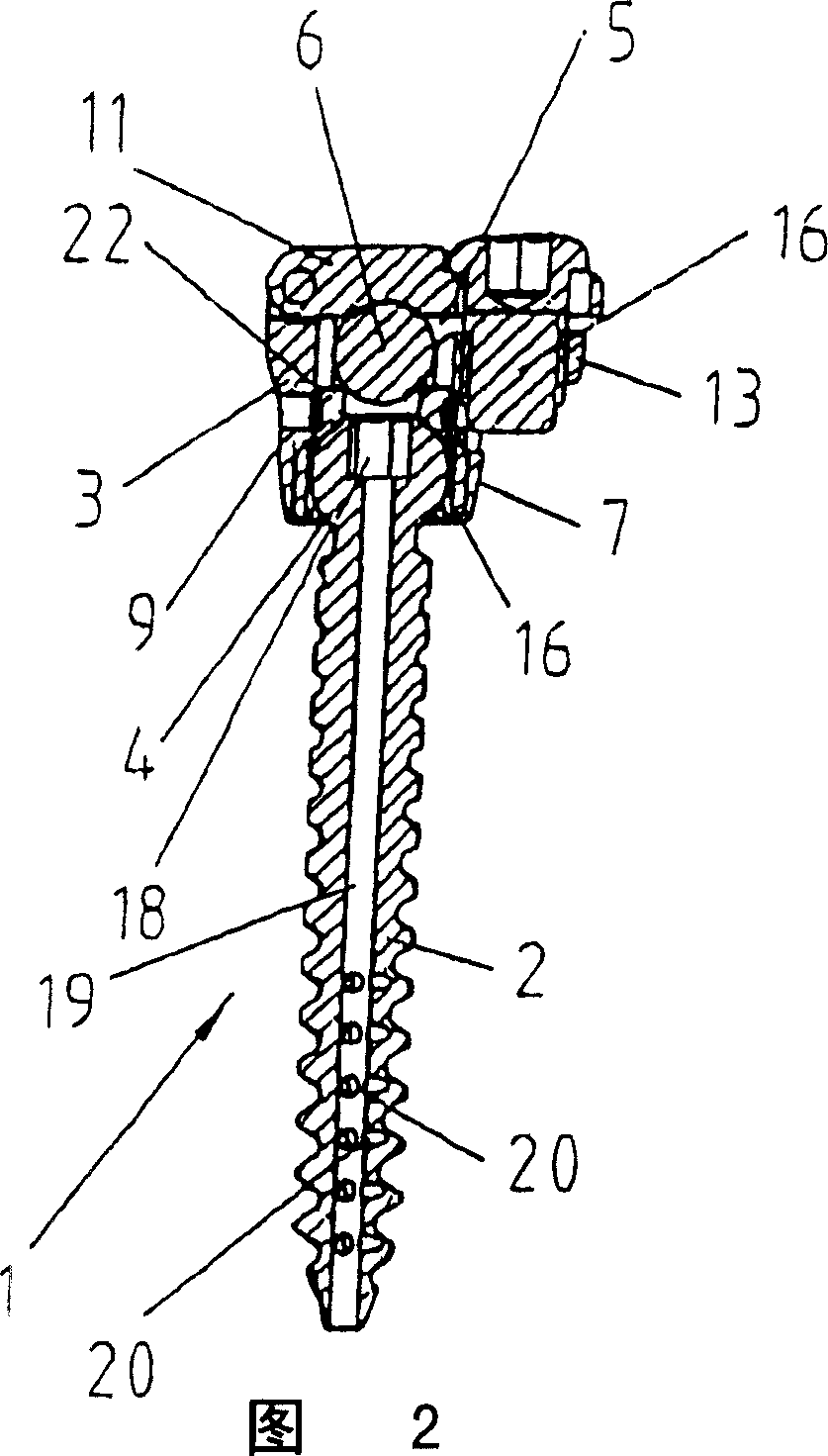 Pedicle screw