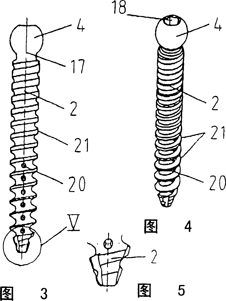 Pedicle screw