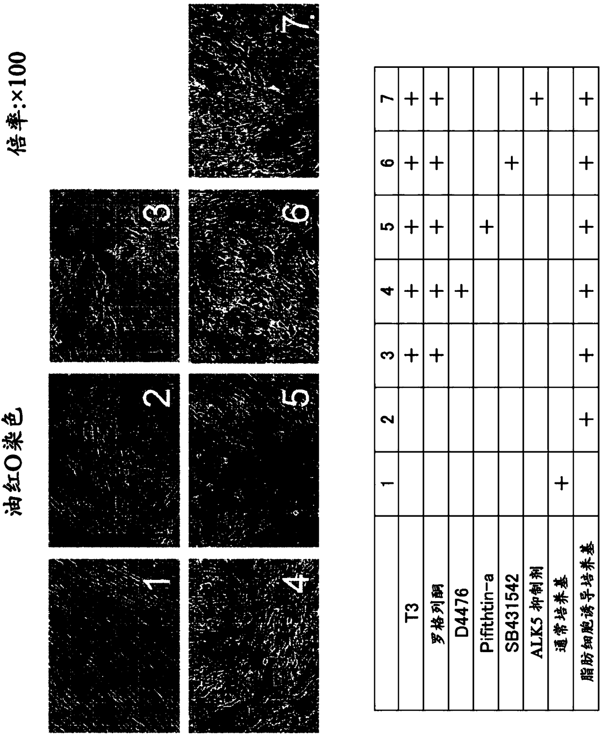 Method for preparing brown adipocyte