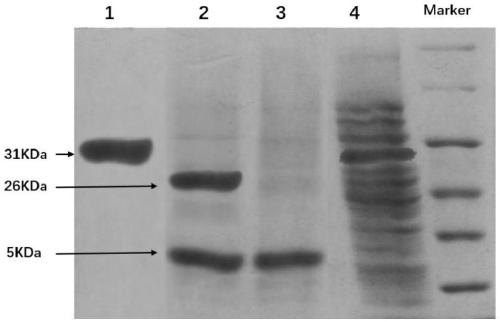 Preparation method and application of targeting exosome