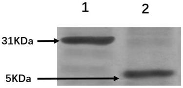 Preparation method and application of targeting exosome