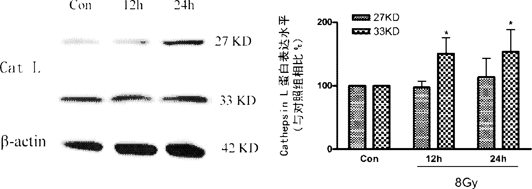 Use of cathepsin L inhibitor in preparation of radiotherapeutic sensitization drug