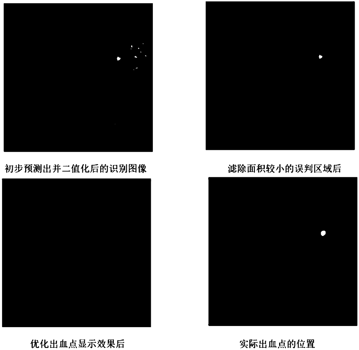 Intelligent recognition of bleeding points in capsule gastroscopy images based on Adaboost machine learning