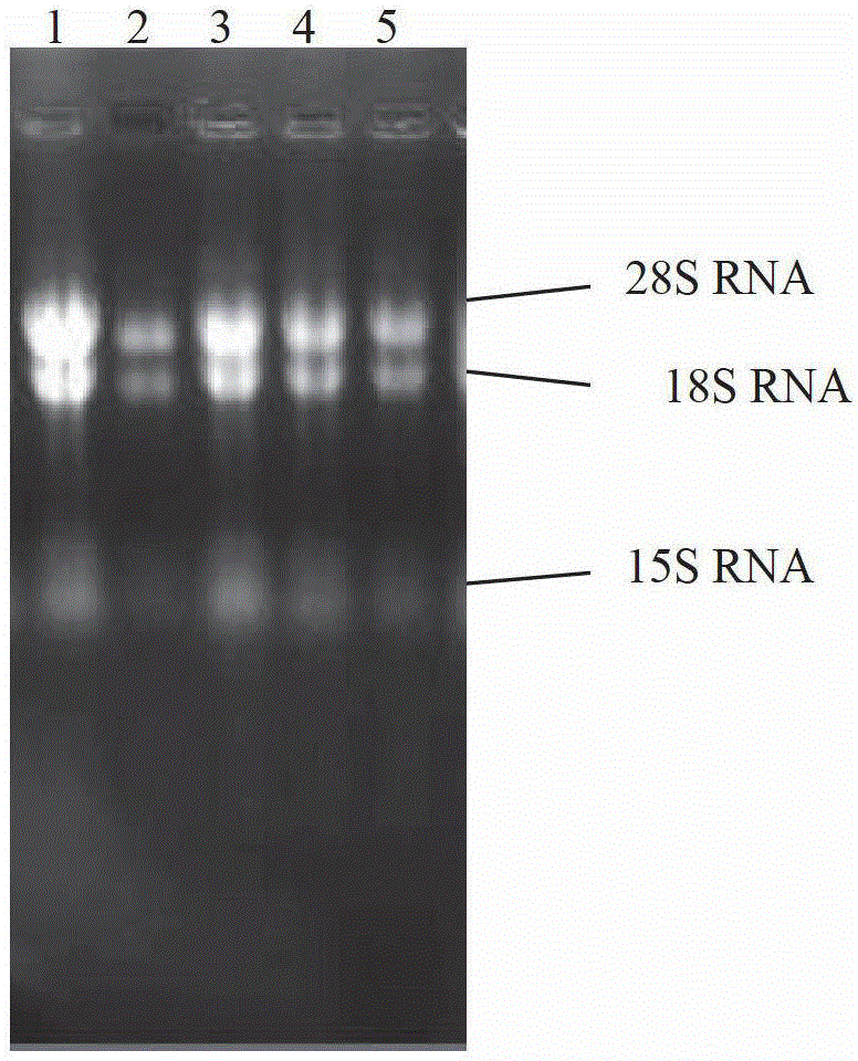 Cordyceps sinensis delta-5-desaturase used in anabolism of eicosapentaenoic acid, and gene and application thereof