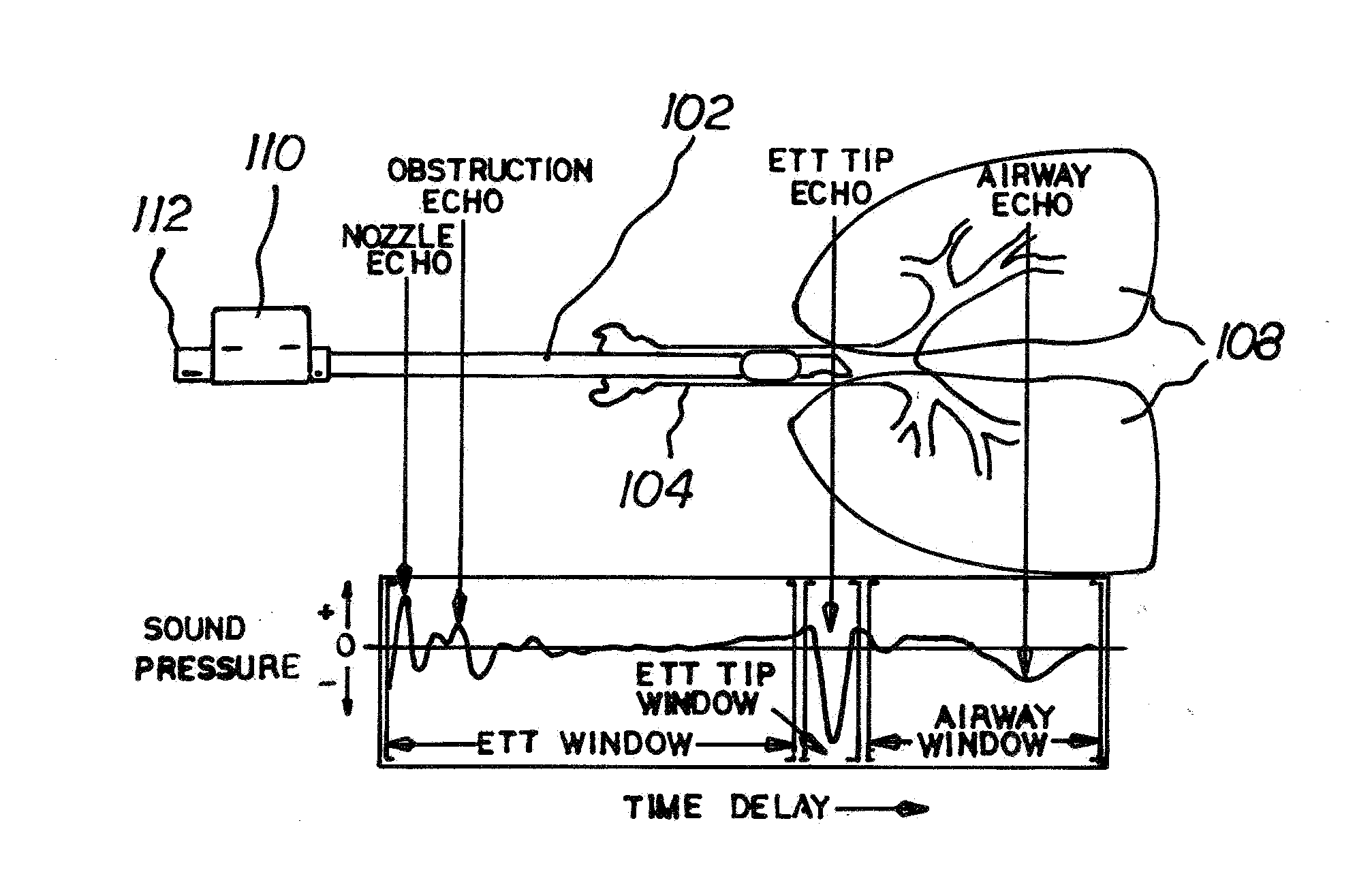 System and Method for Use of Acoustic Reflectometry Information in Ventilation Devices