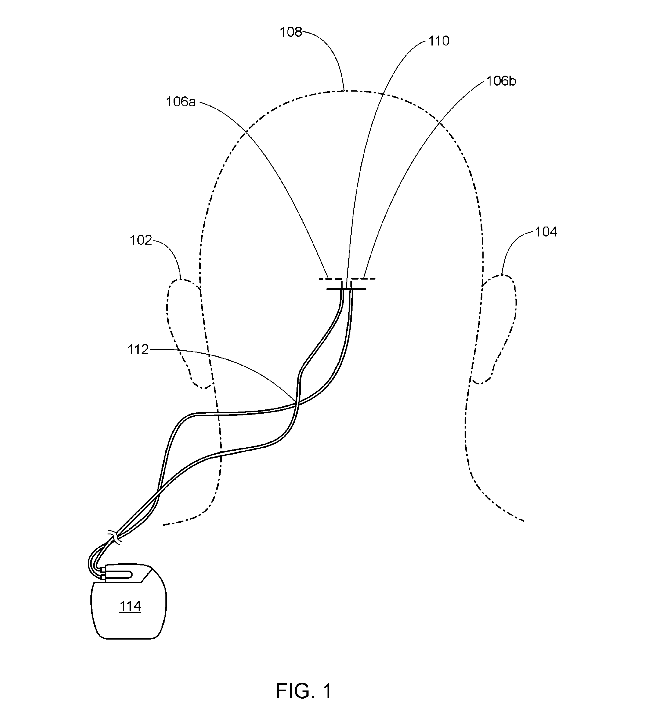 Occipital neuromodulation