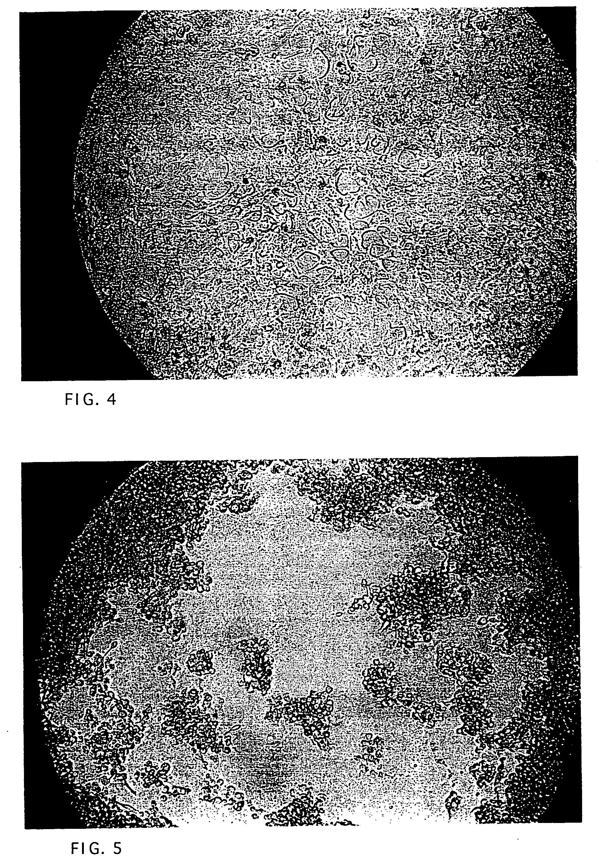 Polypeptide for the treatment of cancer and a method for preparation thereof