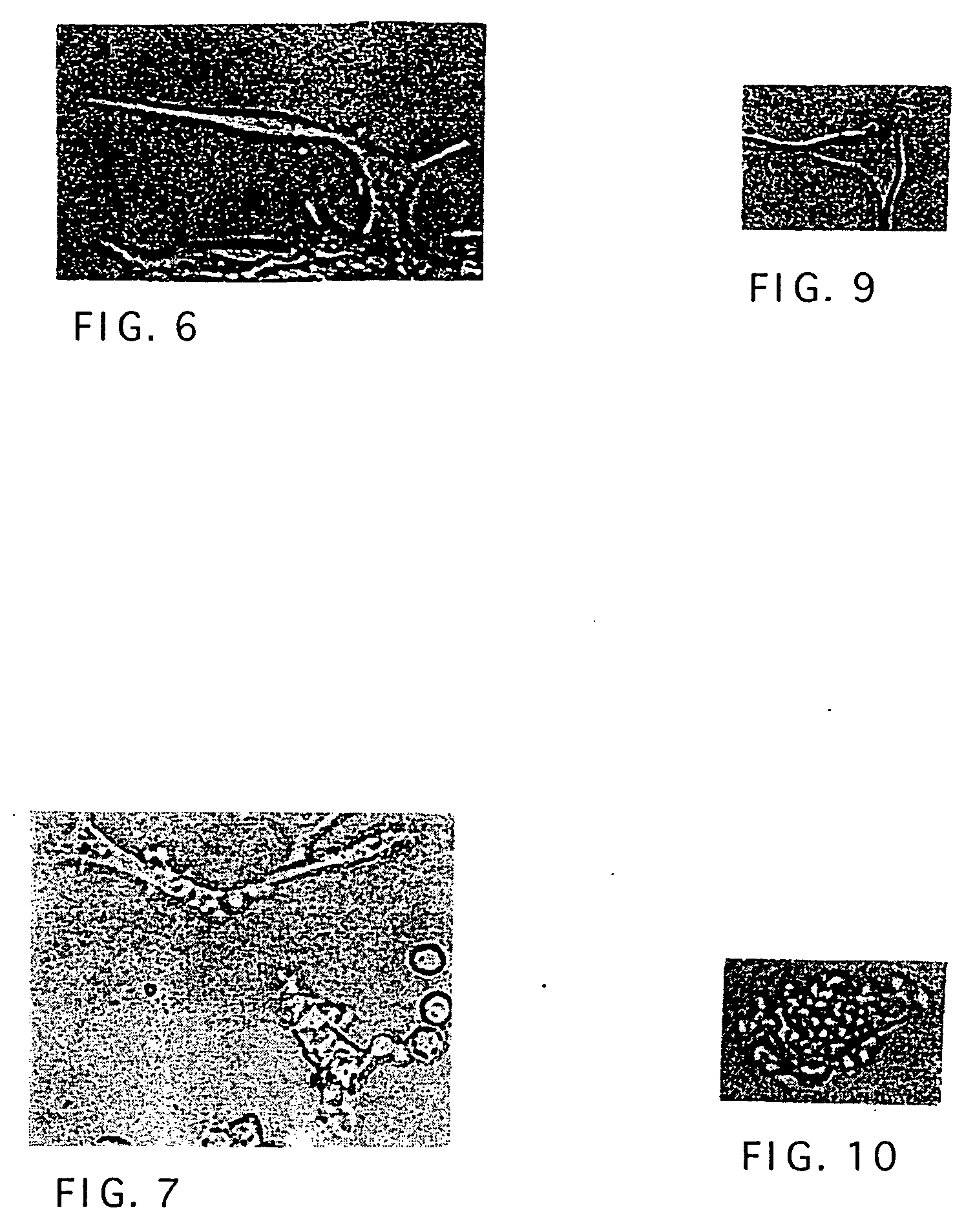 Polypeptide for the treatment of cancer and a method for preparation thereof