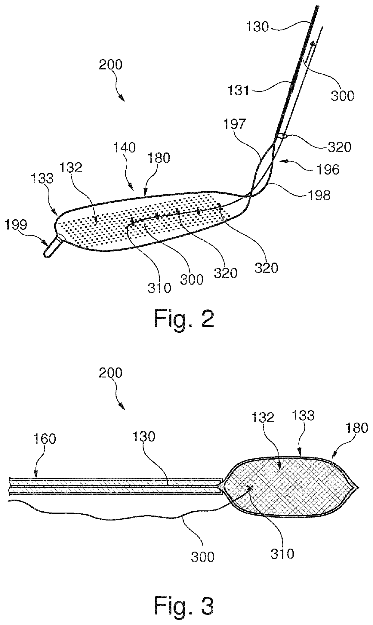 Embolic protection device and method