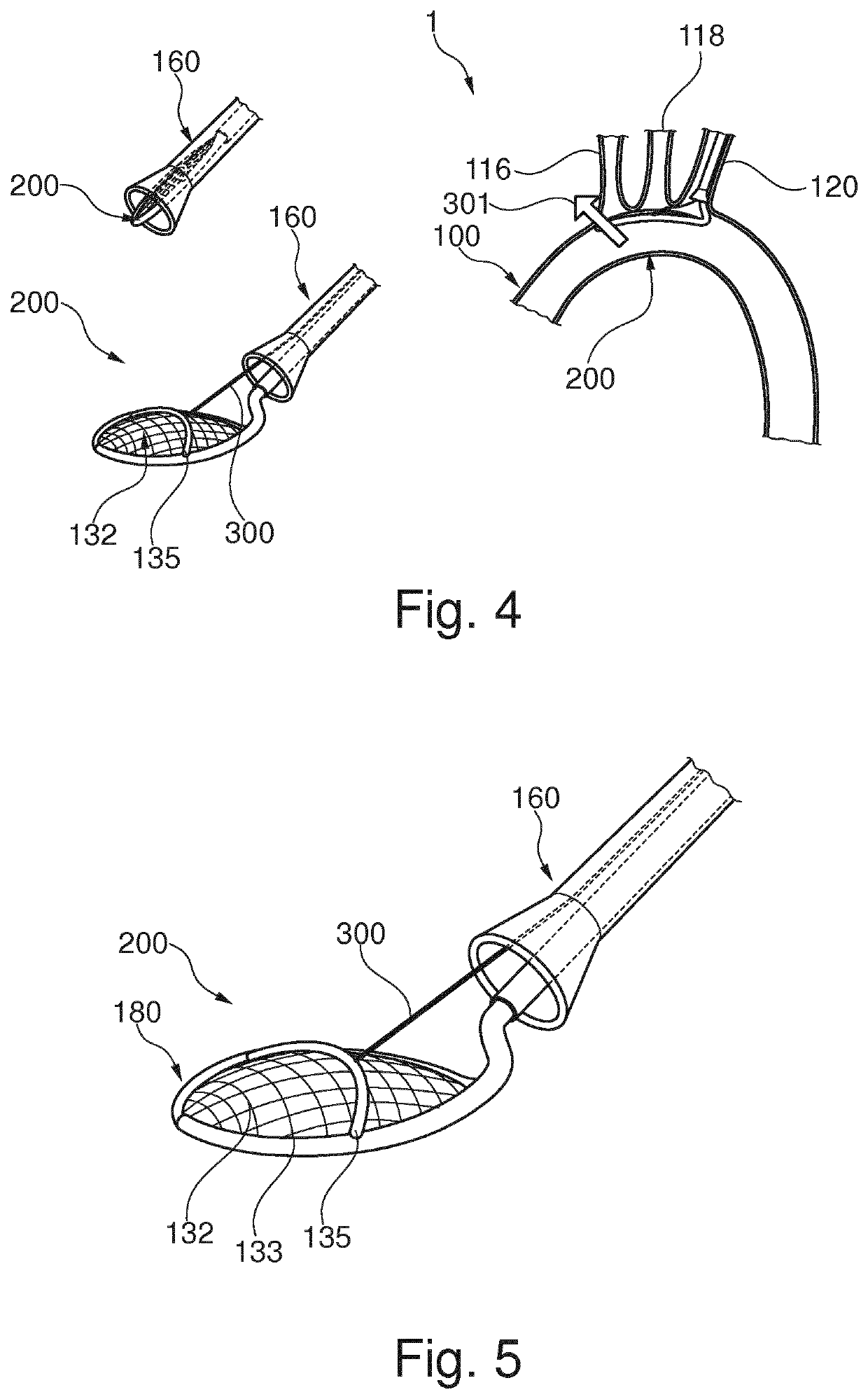 Embolic protection device and method