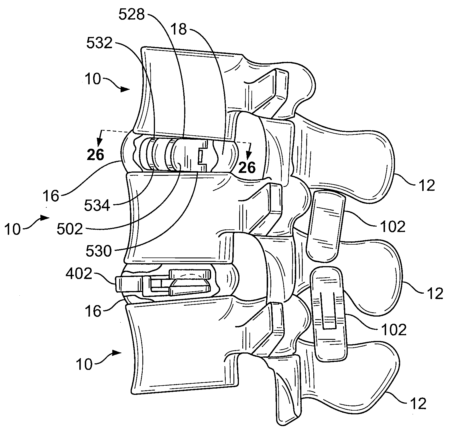 Intervertebral Implant Devices and Methods for Insertion Thereof