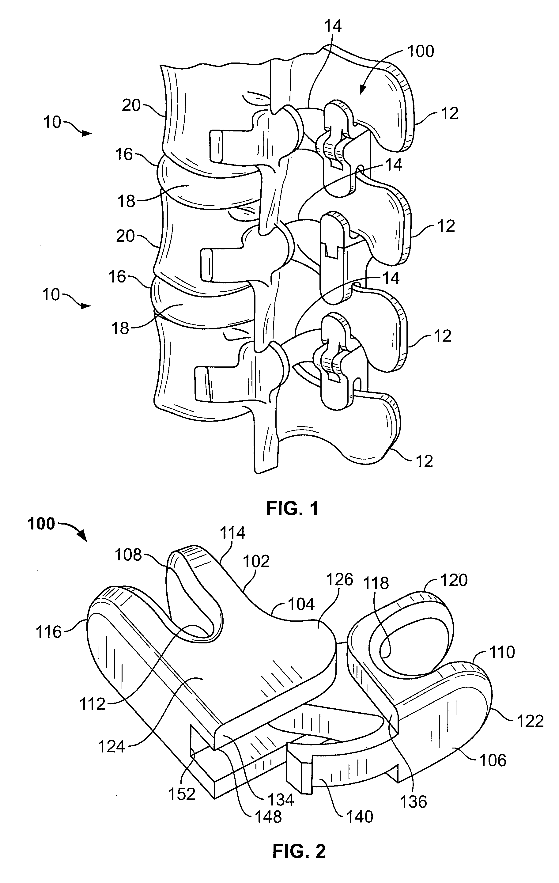 Intervertebral Implant Devices and Methods for Insertion Thereof