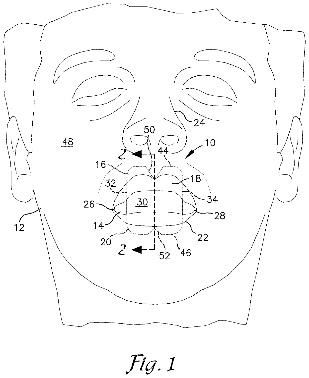 Snore reducing mouthpiece