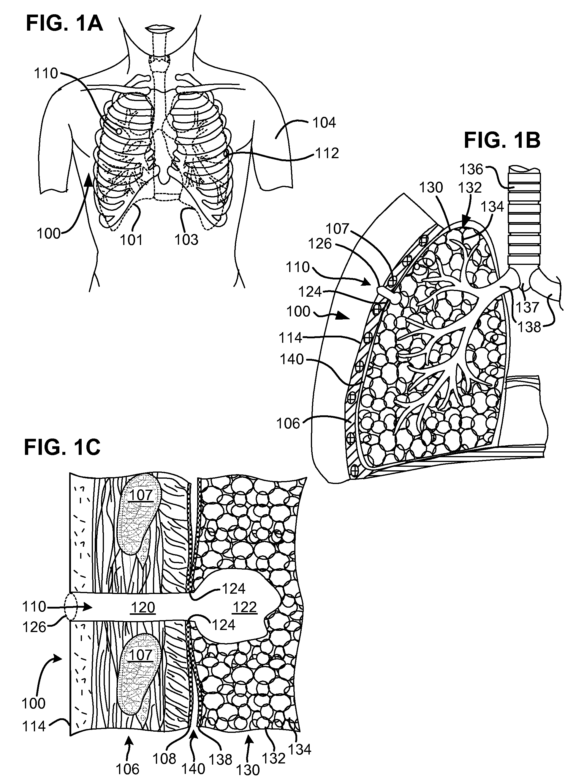 Methods and devices for assessment of pneumostoma function