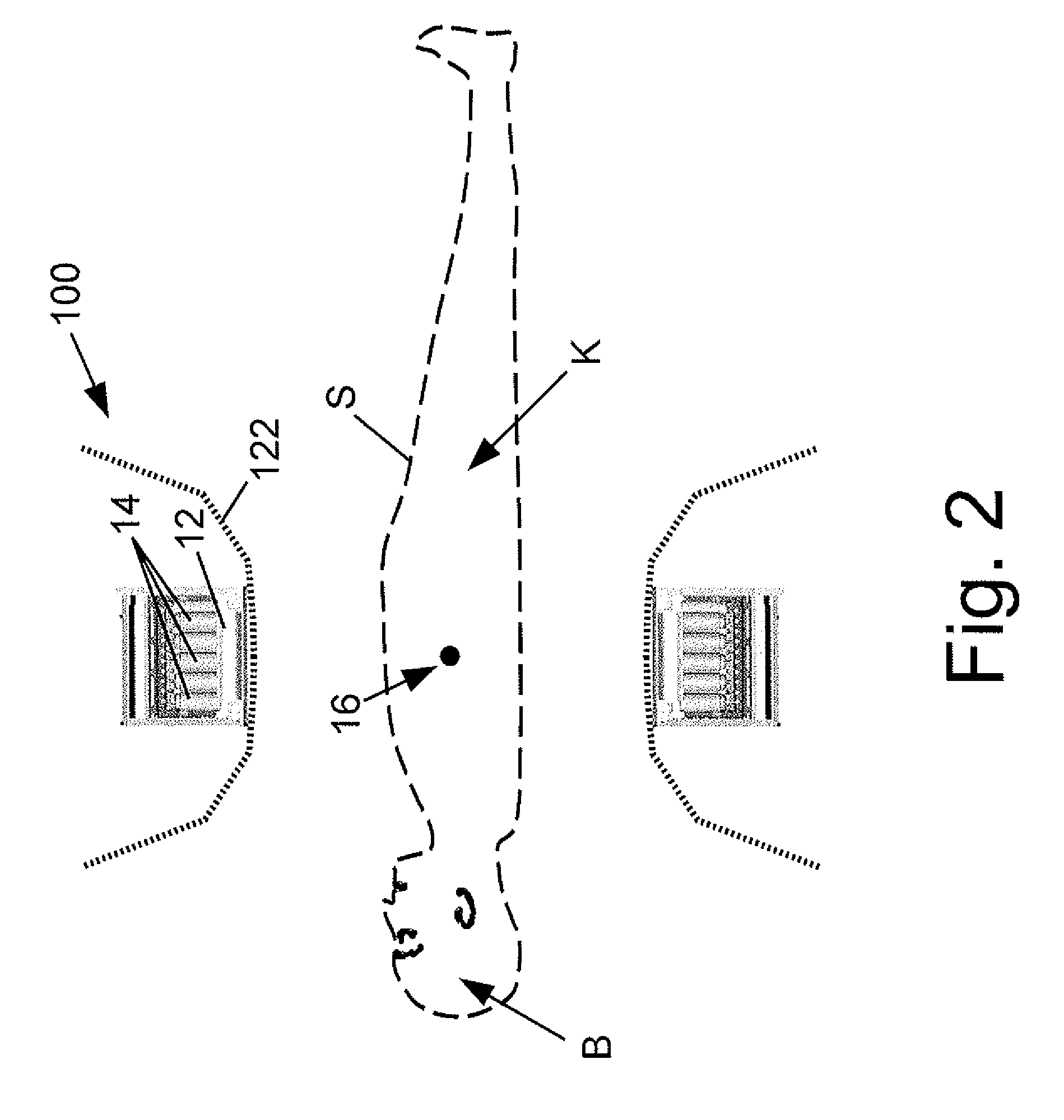 Large bore PET and hybrid PET/CT scanners and radiation therapy planning using same