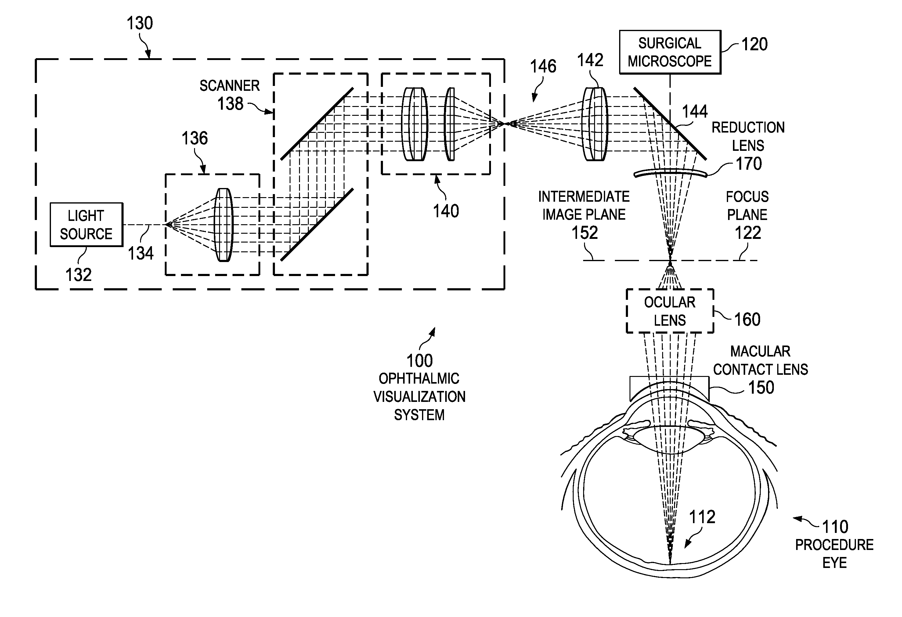 Oct surgical visualization system with macular contact lens