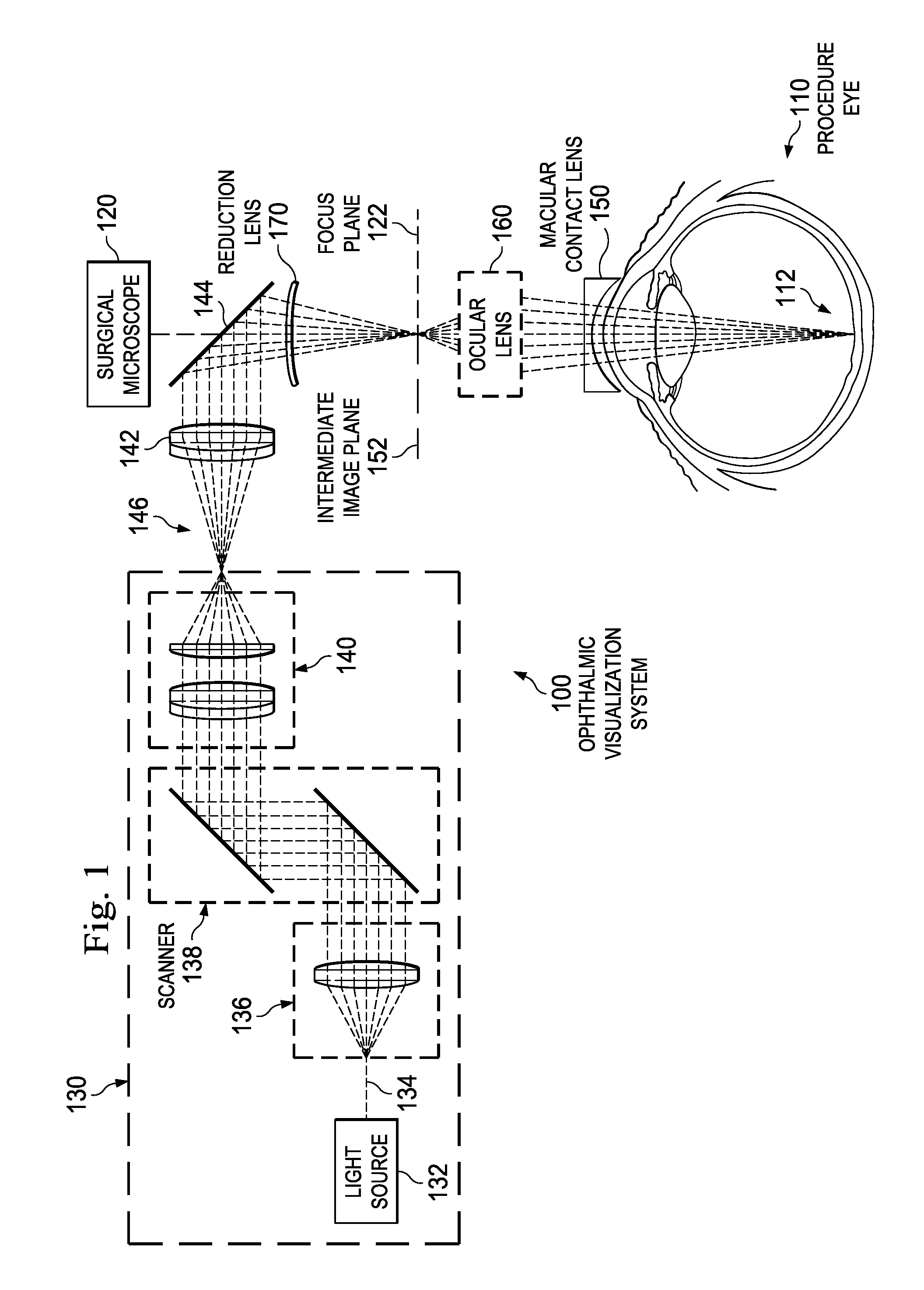 Oct surgical visualization system with macular contact lens