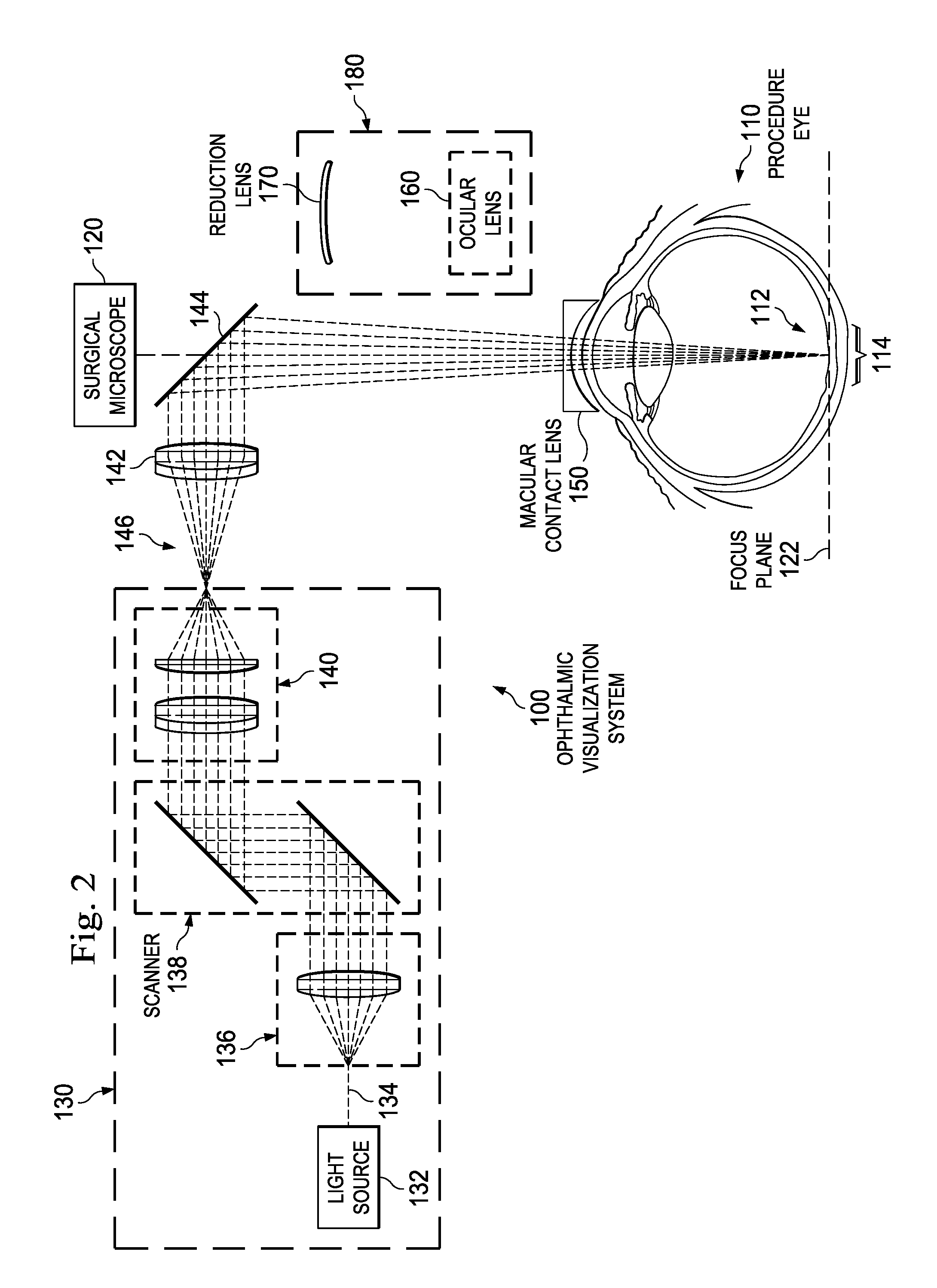 Oct surgical visualization system with macular contact lens