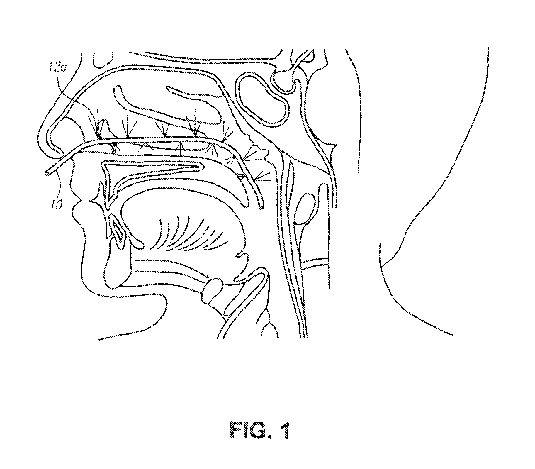 Methods and devices for non-invasive cerebral and systemic cooling