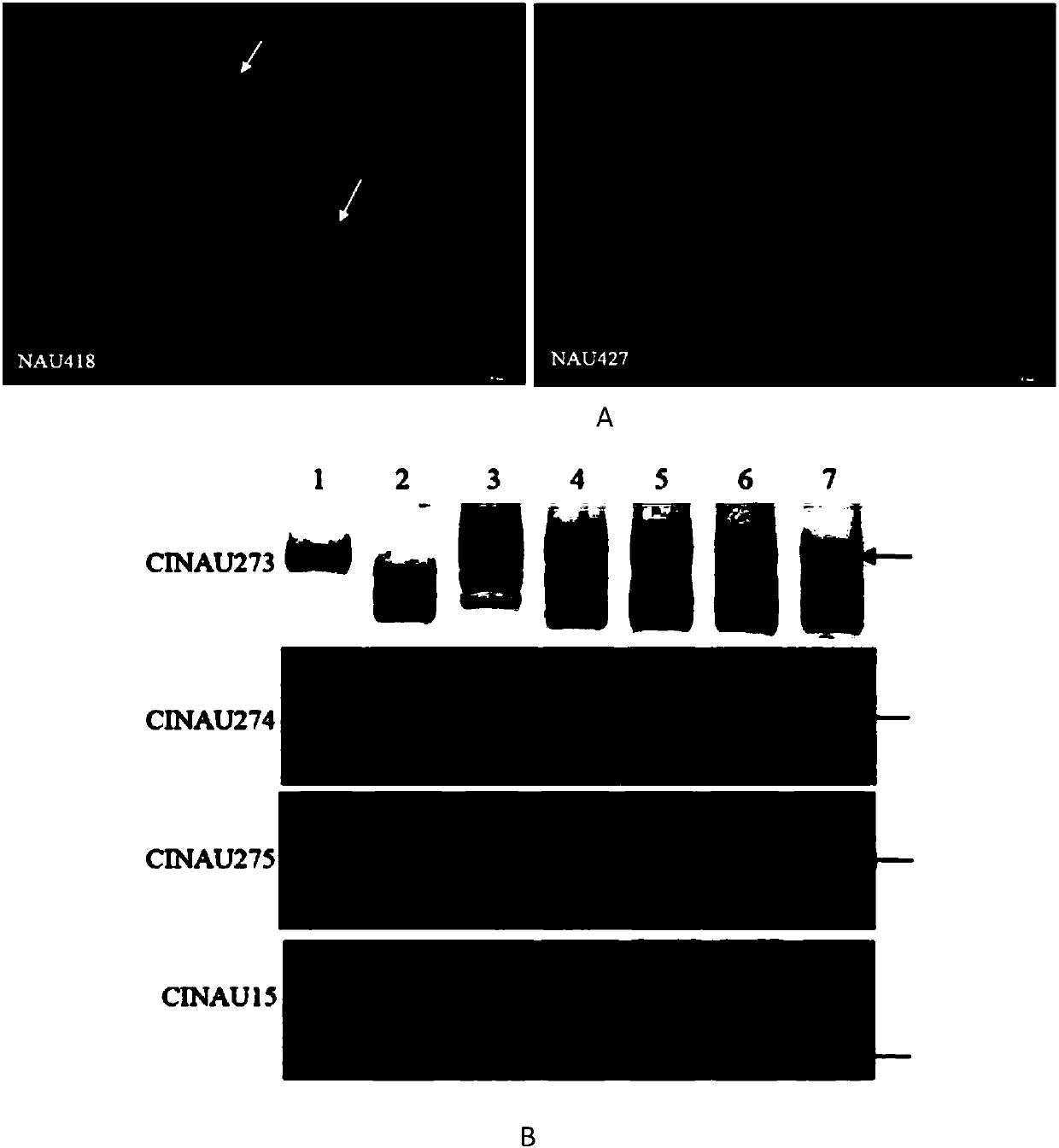 Molecular markers linked with disease resistance gene Pm21 of wheat and application of molecular markers in breeding