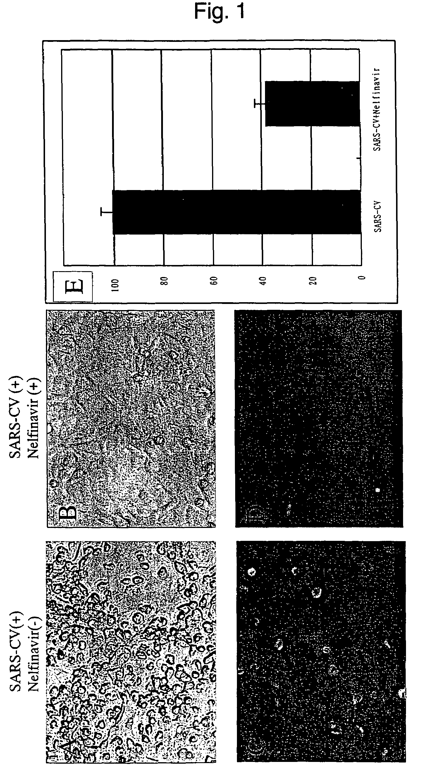 Anti-coronavirus drug