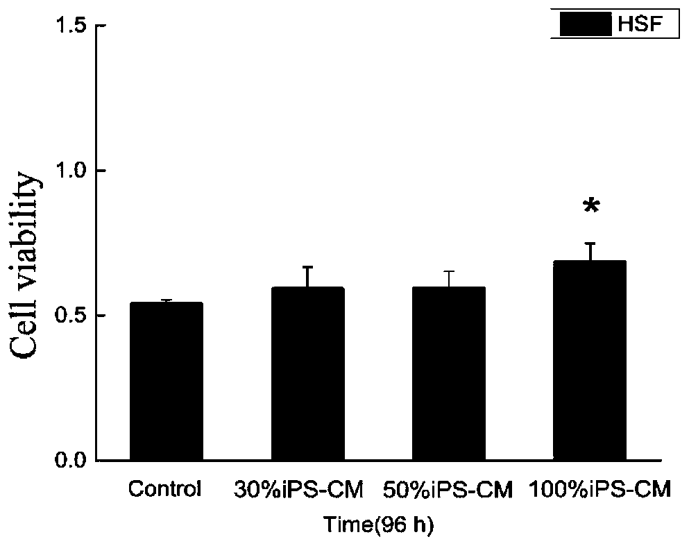 iPS cell culture supernatant as well as preparation method and application thereof