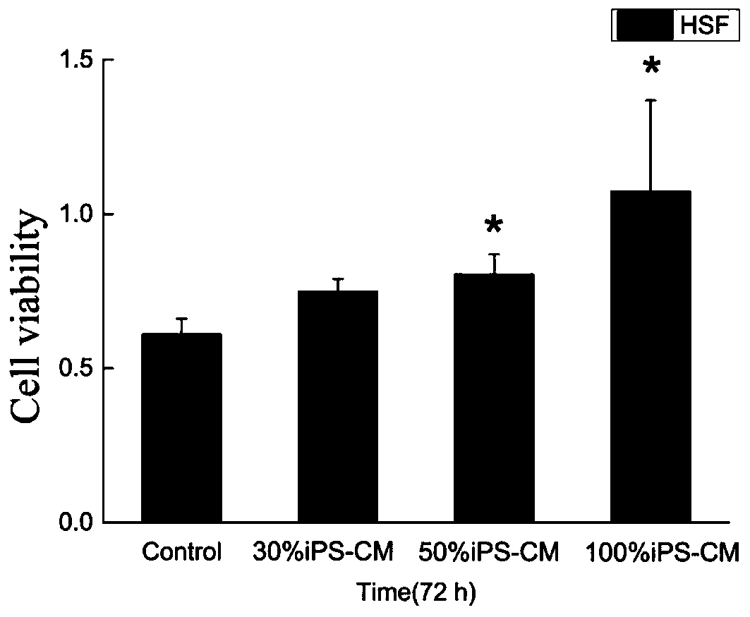 iPS cell culture supernatant as well as preparation method and application thereof