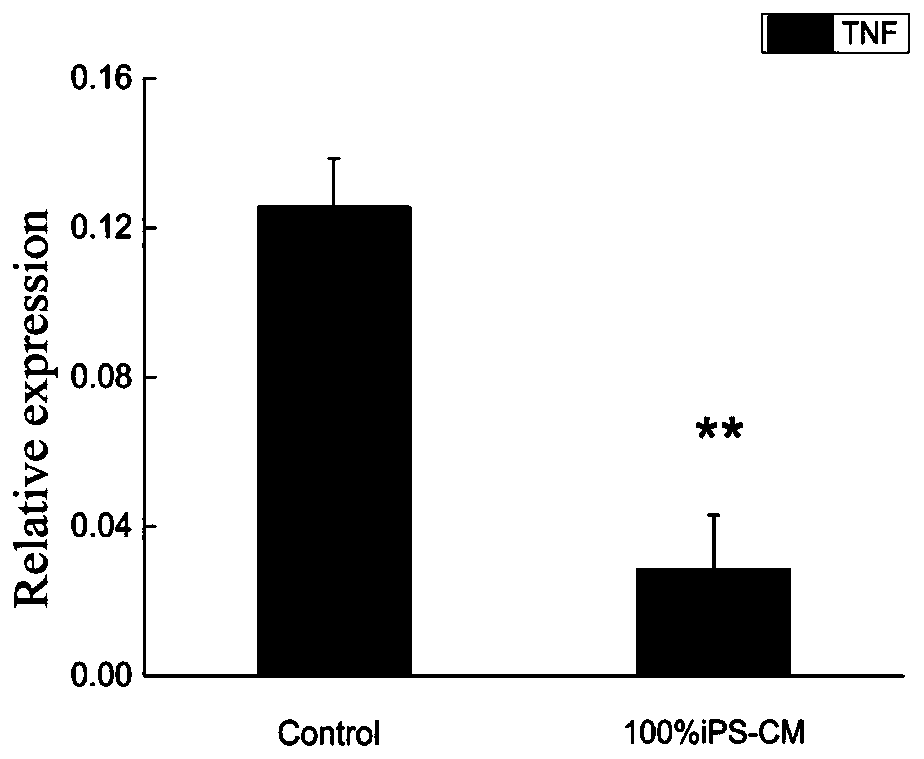 iPS cell culture supernatant as well as preparation method and application thereof