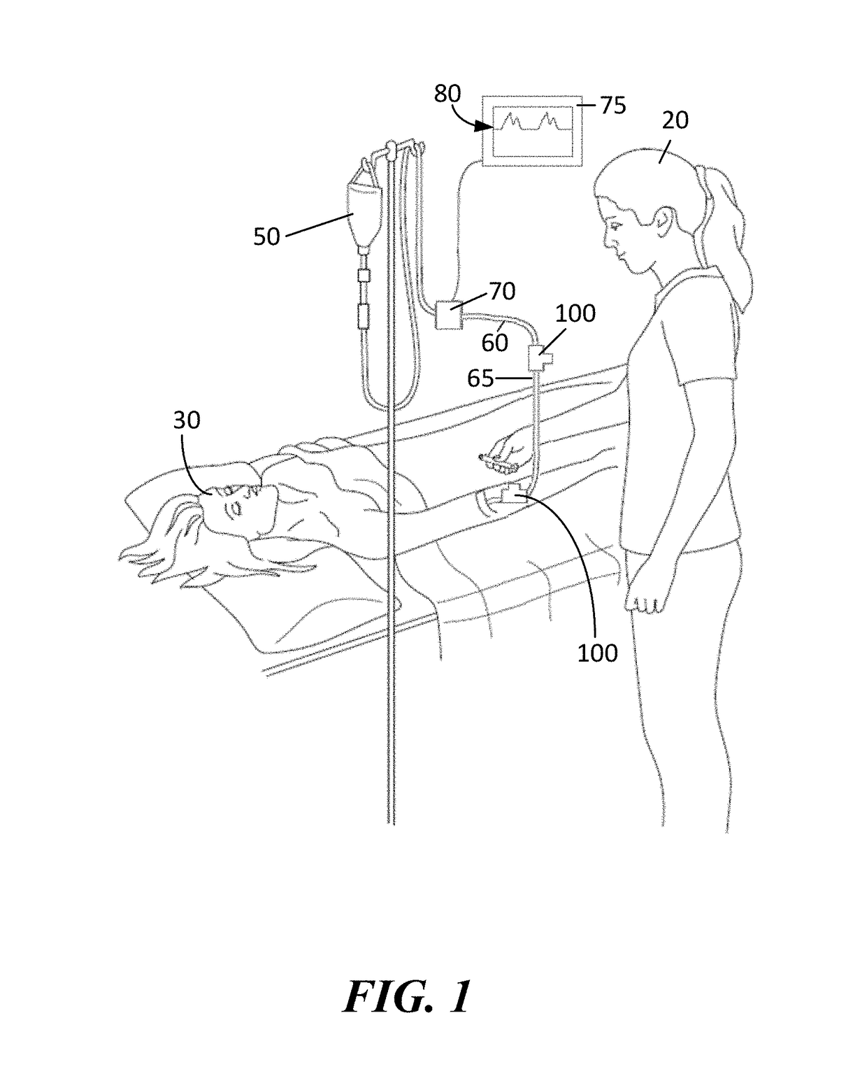 Sampling Port for Hemodynamic Monitoring Systems