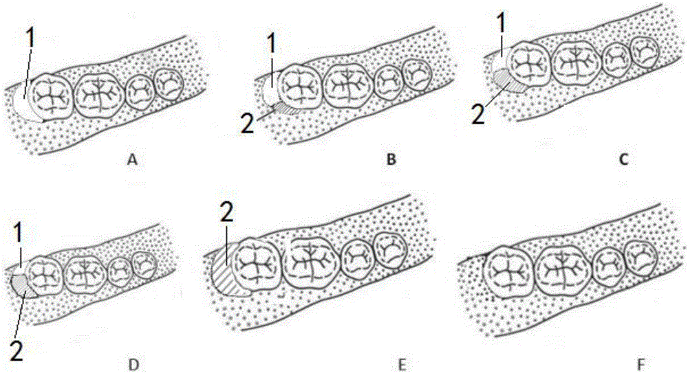 Bone tissue repair material based on shape memory composite material as well as preparation method and application method of bone tissue repair structure